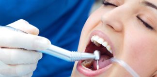Implantes dentales Murcia